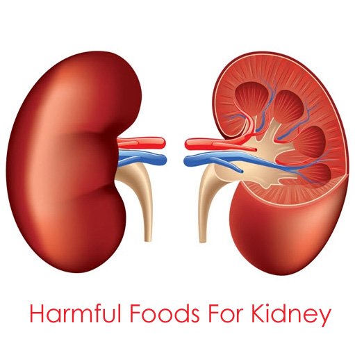 Top Foods to avoid with kidney disease