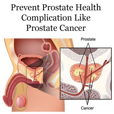 Prevent Prostate Health Complication