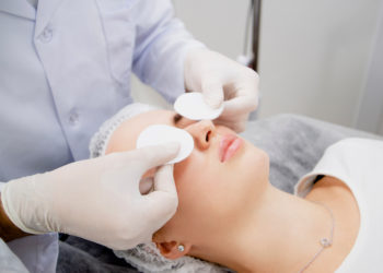 Laser Treatment for Dark Spots on Face